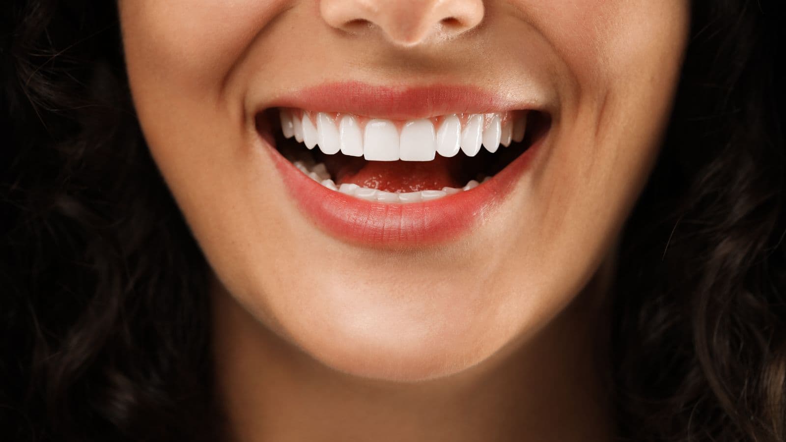 Hollywood-Smile — Illustration eines bariatrischen Eingriffs