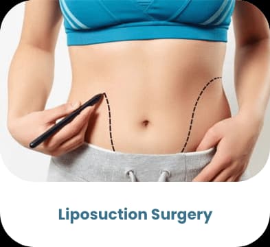 Liposuktion — bariatrische Behandlung