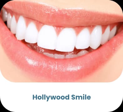 Hollywood-Smile — bariatrische Behandlung