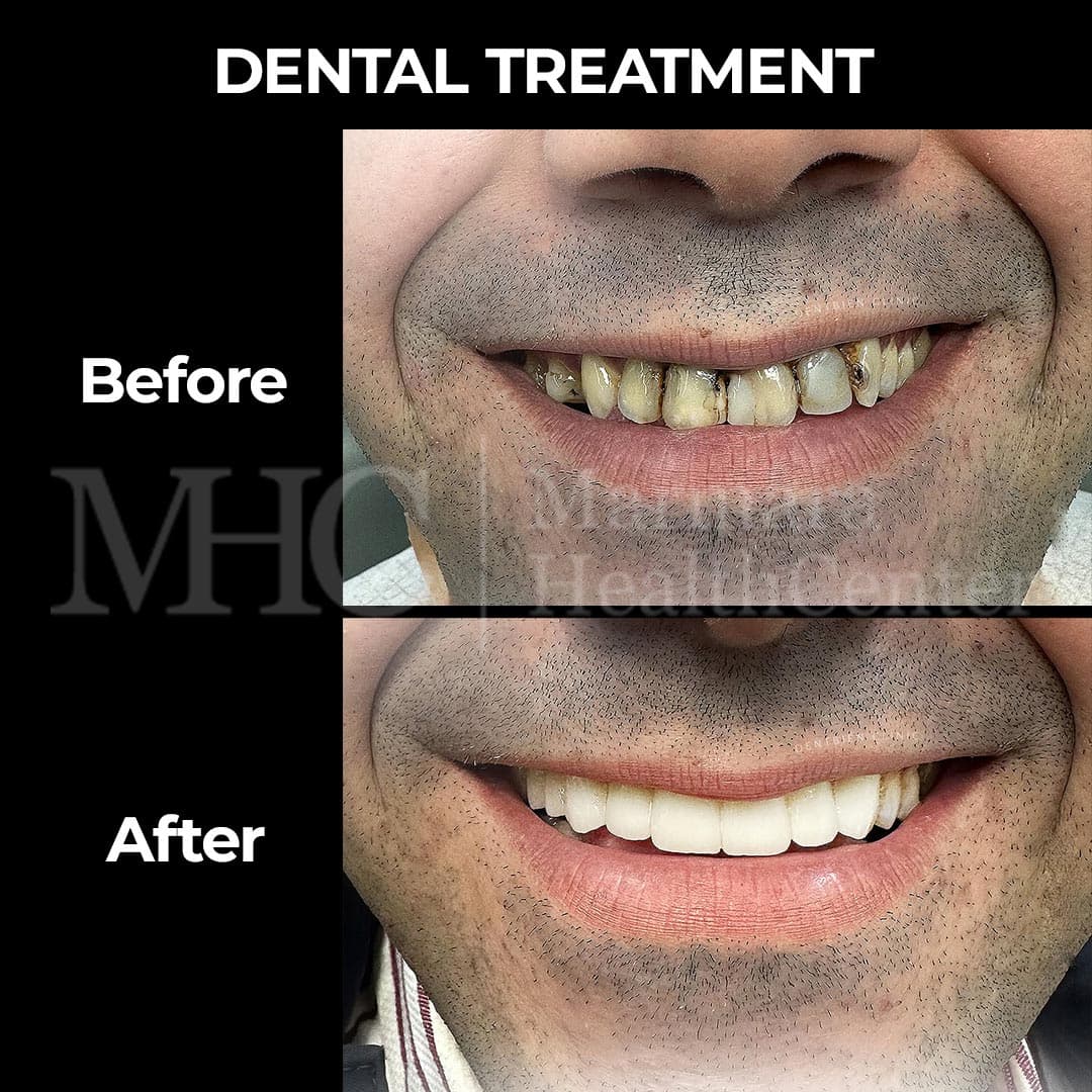 Dental treatment before-after result